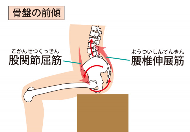 脊柱管狭窄症の骨盤　背骨