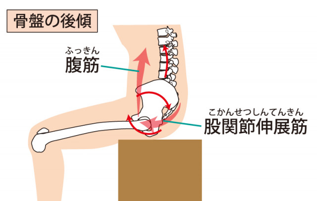 椎間板ヘルニア　骨盤　背骨