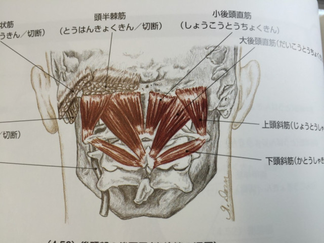 めまい　ふらつき　後頭三角