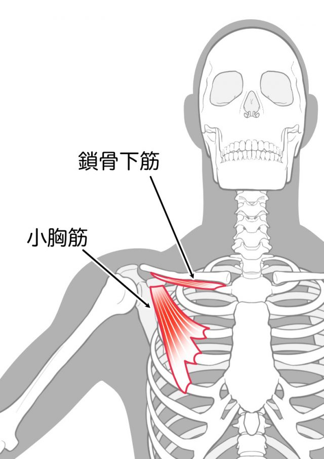 腕や手のシビレ　胸郭出口症候群　小胸筋